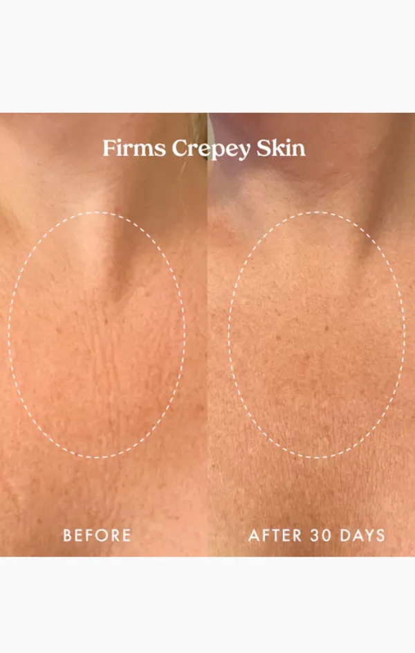 Ultra Renewal Retinol Body Cream